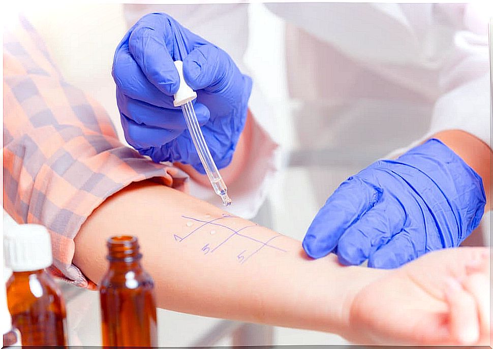 Doctor conducting allergy tests on a patient.