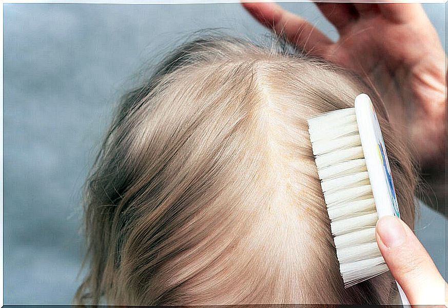 Combing head of a girl with cradle cap