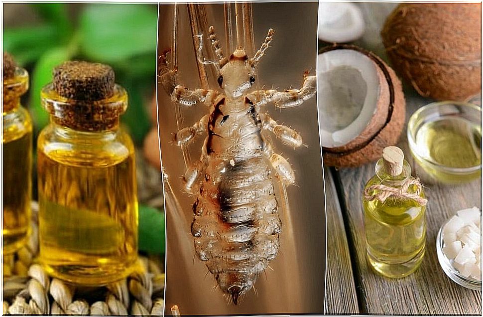 How to make 5 home remedies to get rid of lice and nits