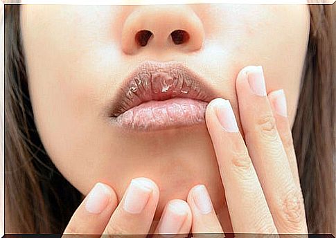 Aspirin can help chapped lips