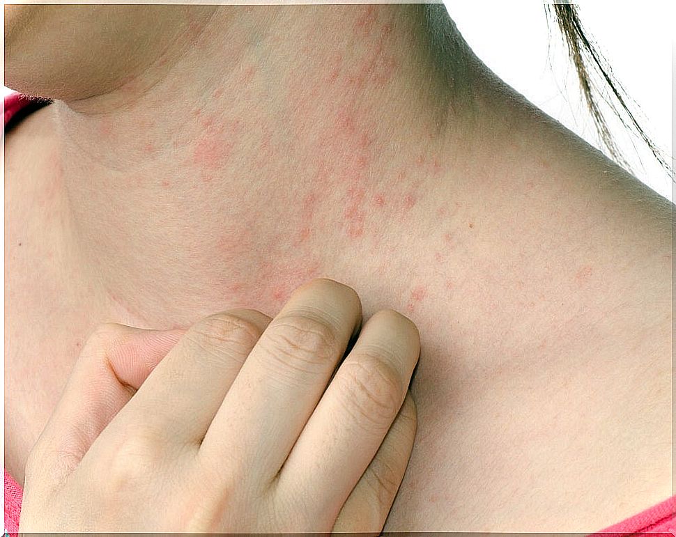 skin diseases