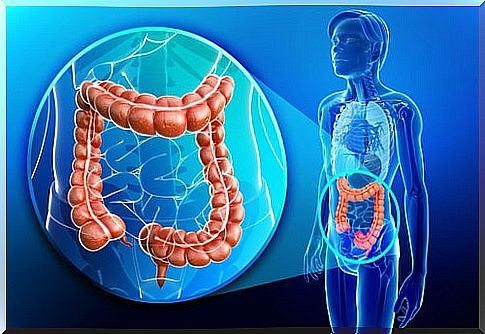 Ulcerative colitis